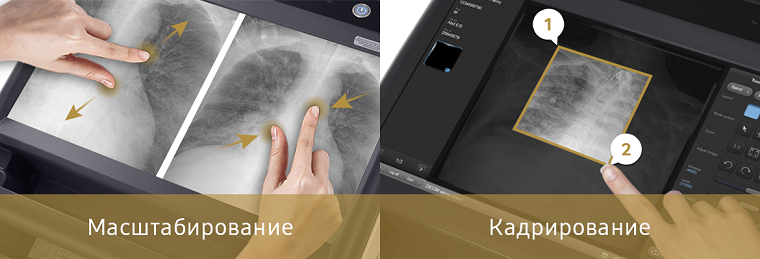 рентген_аппарат_gm85_samsung